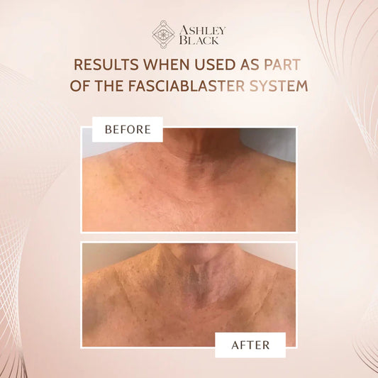 Hydrogel Decollete Patch