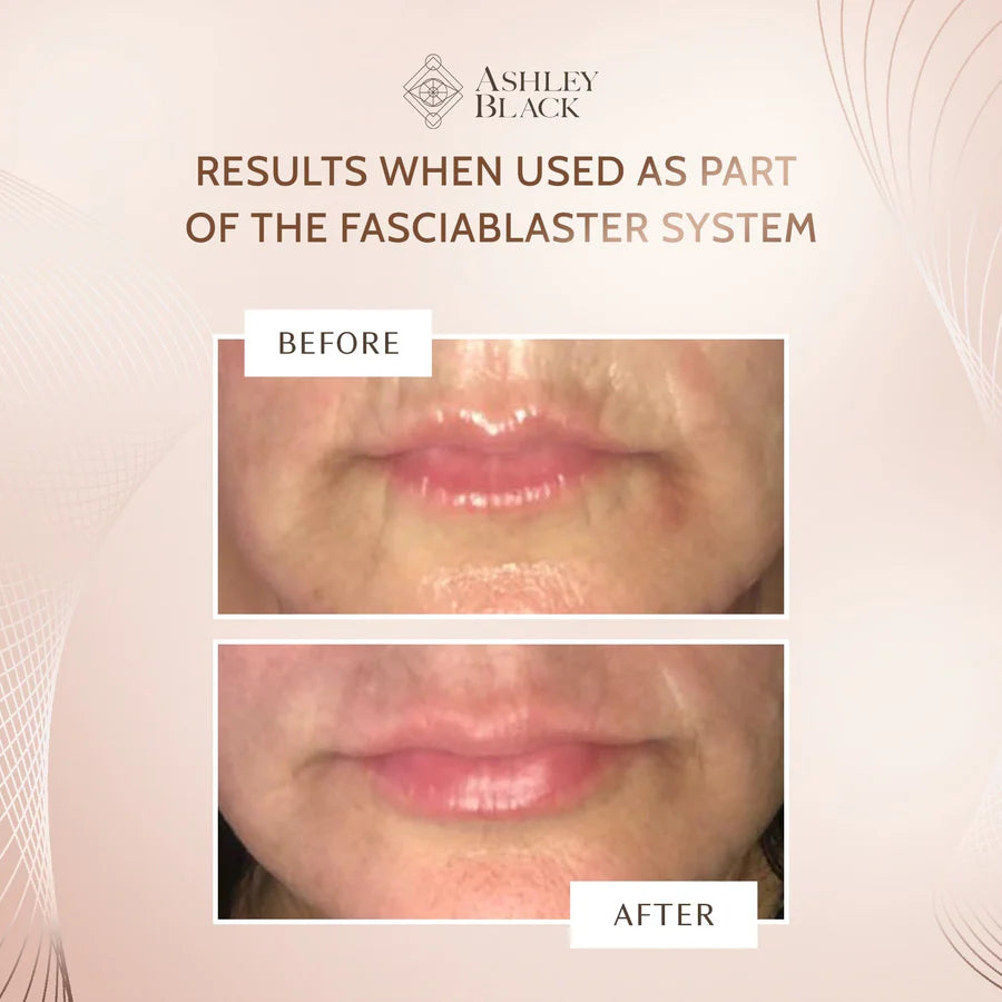 Hydrogel Lip Patch