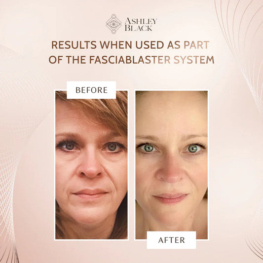 Single Claw Wrinkle Blaster With Handle