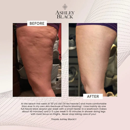 The Original Fascia Blaster by FasciaBlaster®